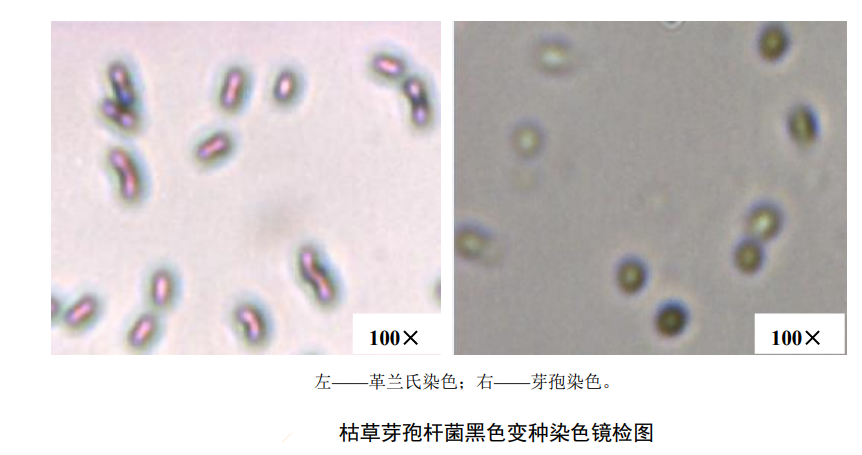 Microscopic examination of Bacillus subtilis var. black